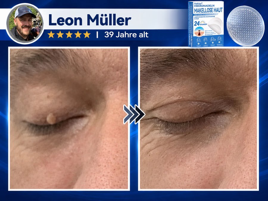 Leon Müller