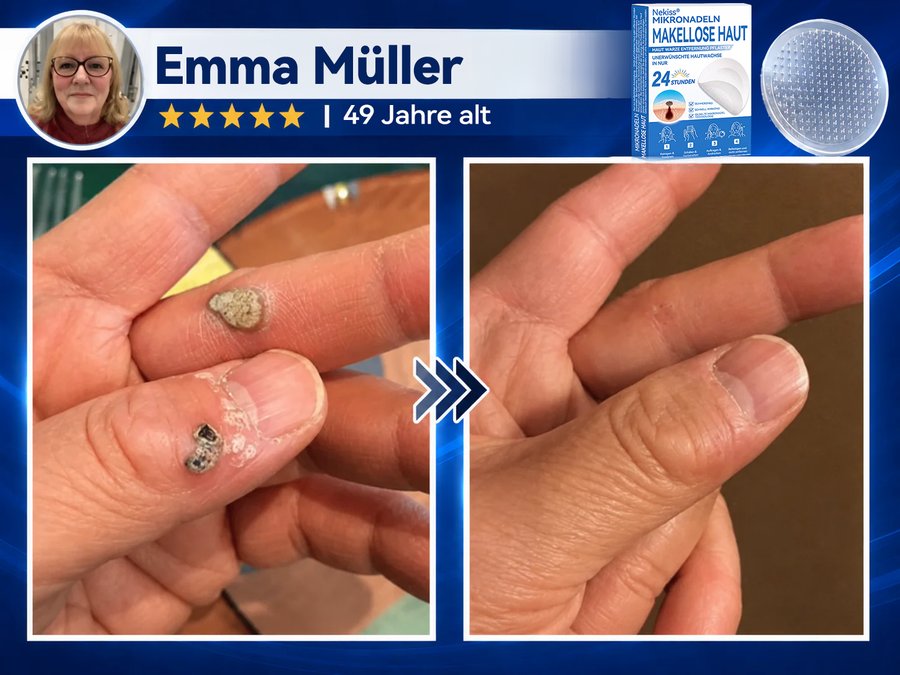 Emma Müller